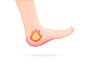 hot sensation on the heel of the foot. heel aches, pains, and hot. The feet feel hot as burn sensation. health problems. Minimalist 3D illustration design. vector elements. white background