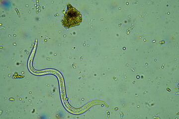 arcella, fungi and nematode in a soil sample on a farm