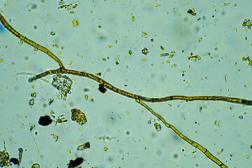 arcella, fungi and nematode in a soil sample on a farm