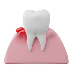 dental gingivitis, bleeding gums with teeth 3D rendering.