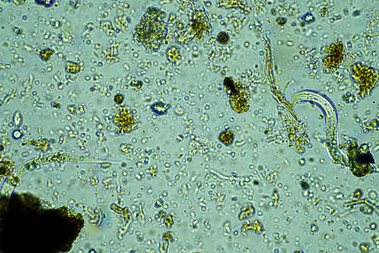 microorganisms under a microscope at 400x magnification