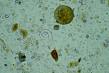 microorganisms under a microscope at 400x magnification