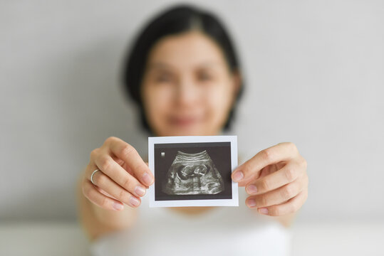 Happy Young Pregnant woman holding showing ultrasound scan photo. Smiling Asian Mother with sonogram of her unborn baby. Concept of pregnancy, Maternity prenatal care