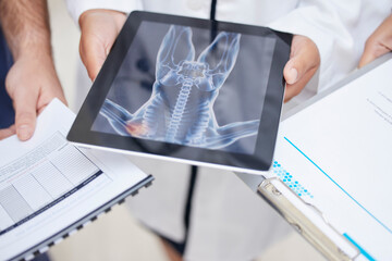 Doctor, hands and tablet with x ray in anatomy, surgery or results in MRI, CT or body scan at...