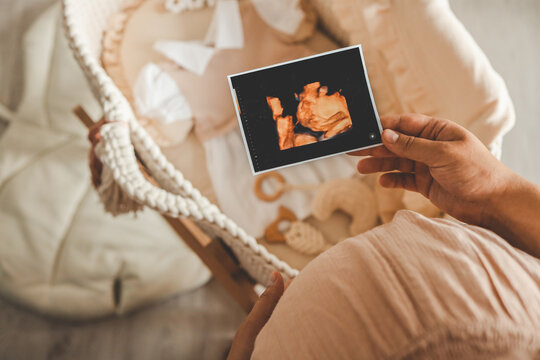Ultrasound picture pregnant baby photo. Woman holding ultrasound pregnancy image. Concept of pregnancy, maternity, expectation for baby birth
