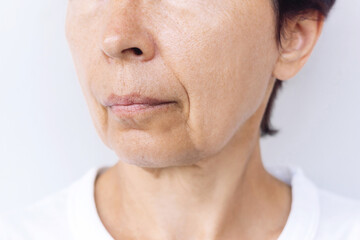 The lower part of elderly woman's face and neck with signs of skin aging isolated on a white...