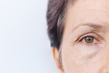 Close up of an elderly caucasian woman's face with puffiness under her eyes and facial wrinkles...