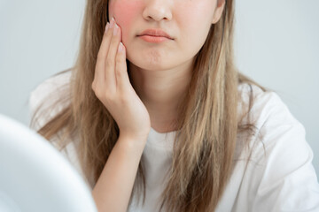 Young woman asian are worried about faces Dermatology and allergic to steroids in cosmetics....