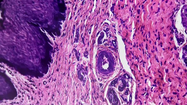 A microscopic view of a cross sectional view of the human penis under 200x magnification against a bright field background. Male reproductive organ is being studied to analyze its anatomical structure