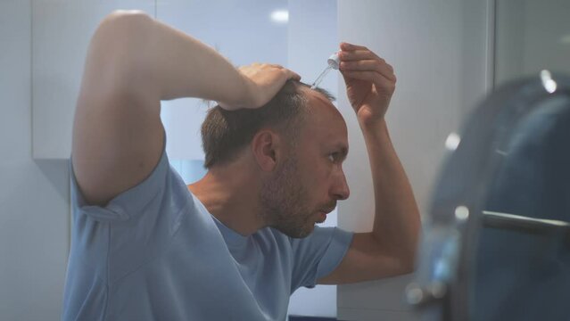 Man worried about hair loss and baldness drips serum or medicine oil product at home bathroom to stimulate hair growth and health