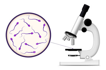 Enlarged view of the sperms under a microscope. sperms for semen analysis. Sperm donation concept.
