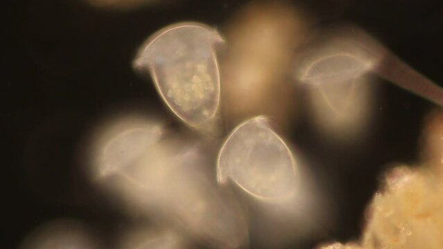 Study of protozoa and Algae under the microscope for education.