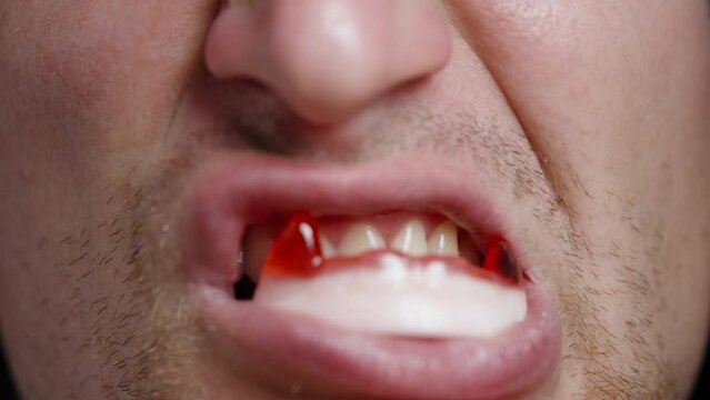 A young man grins with gummy candy in the shape of vampire fangs in his mouth, close-up shot.