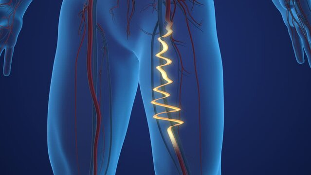 Thighs with twisted enlarged varicose veins