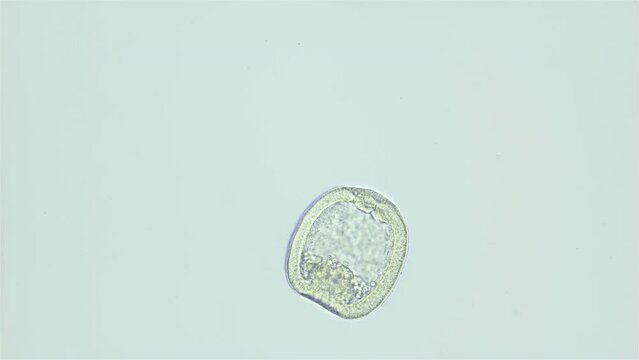 Larva sea urchin Strongylocentrotus pallidus under microscope, phylum Echinodermata. Gastrula stage. White sea