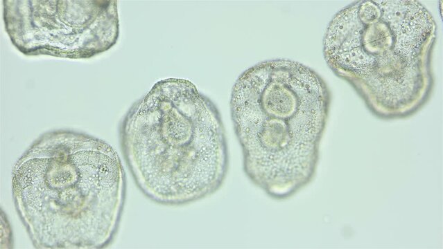 Larvae sea urchin Strongylocentrotus pallidus under microscope, phylum Echinodermata. Prism stage. White sea