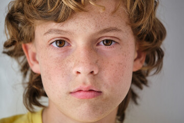 Crop boy with freckles and brown eyes