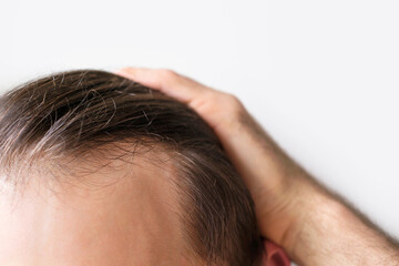 Fototapeta premium Man touching her hair close up on white background, hair loss concept.