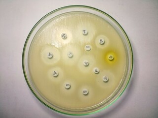 Sensitivity test of E. Coli in mueller Hinton agar.
