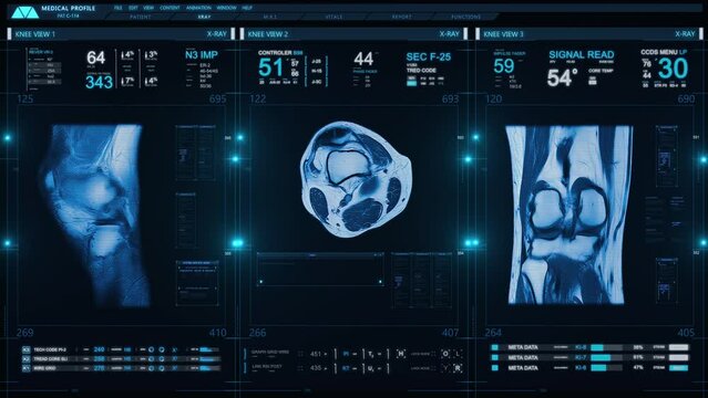 
 Futuristic Technological Interface Analyzing Human Anatomy. Medical Profile of Patient Showing Knee MRI Scan, Joint Region, Vital Signs and Several Healthcare Information Charts and Data.
