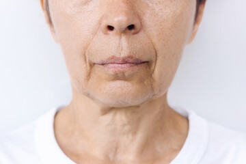 Elderly caucasian woman's face and neck with signs of skin aging isolated on a white background....
