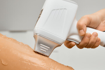 Worker of spa salon evenly makes laser hair removal on woman client leg with wax in office. Use of...