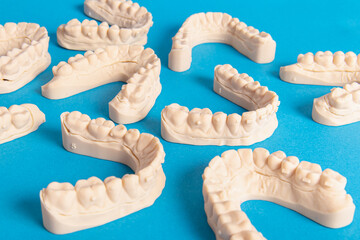 3D printed jaw models for aligners on blue background. Dental master models