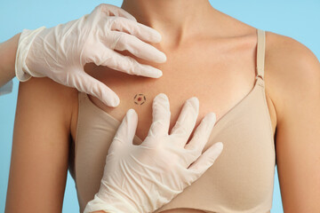 Dermatologist examining marked young woman's mole on blue background, closeup