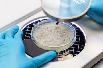 Scientist analysis and cultivate bacteria molds and fungal testing clinical samples, cultured in petri dish. Growth media to isolate total fungal by using colony counter in laboratory.