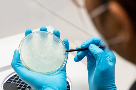 Scientist analysis and cultivate bacteria molds and fungal testing clinical samples, cultured in petri dish. Growth media to isolate total fungal by using colony counter in laboratory.