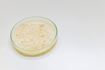 Close-up cultured in petri dish for analysis and cultivate bacteria molds and fungal testing clinical samples.