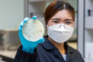 Scientist holding petri dish with bacteria molds and fungal analysis and cultivate testing clinical samples. Growth media to isolate total fungal by using colony counter in laboratory.