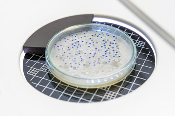 Close-up cultured in petri dish for analysis and cultivate bacteria molds and fungal testing clinical samples. Growth media to isolate total fungal by using colony counter in laboratory.