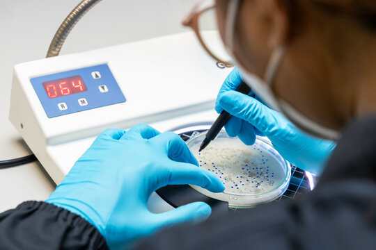 Scientist analysis and cultivate bacteria molds and fungal testing clinical samples, cultured in petri dish. Growth media to isolate total fungal by using colony counter in laboratory.