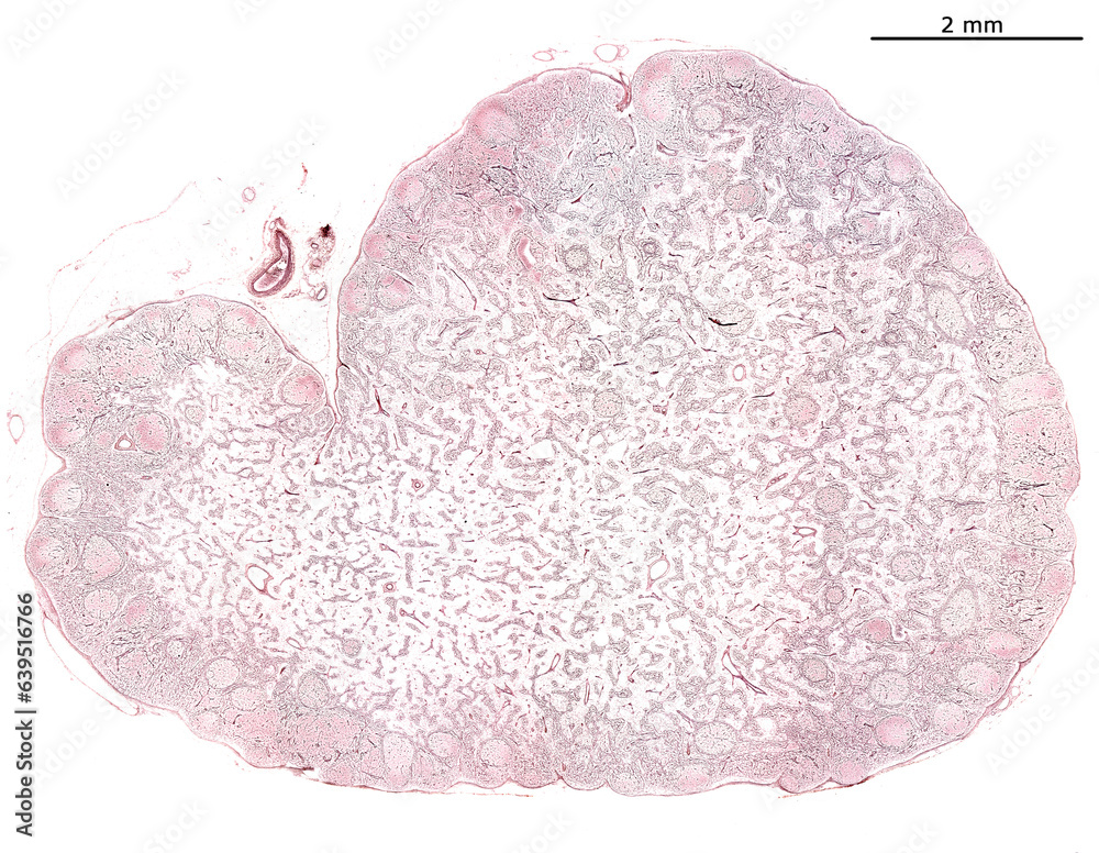 Wall mural lymph node. reticular fibers