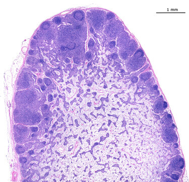 Lymph node