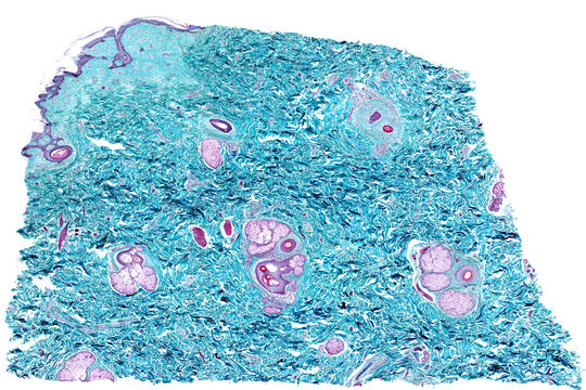 Human skin. Dermis