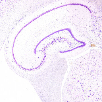 Hippocampus. Ammon&rsquo;s horn