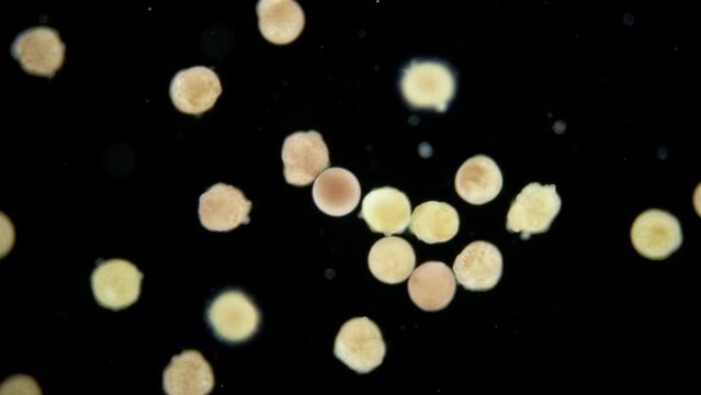 Larvae of sea snail Testudinalia testudinalis under microscope, family Lottiidae. Common name is common tortoise limpet. White sea