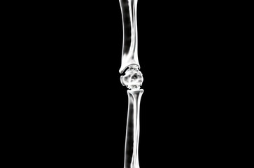 X-Ray image of a bone, Concept of medical tech, fractures and diagnosis. isolated on black background.