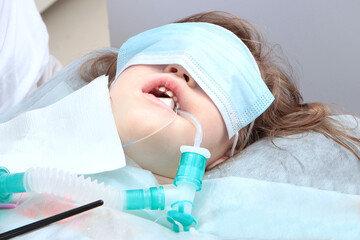Child is under anesthesia. Breathing tube in mouth. Treatment of baby teeth under anesthesia.Open...
