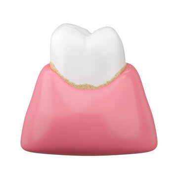 White teeth and tartar with pink gums for dental calculus for oral hygiene concept. 3D rendering.