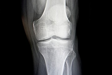 Internal body image of a human joint 