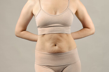 Loose skin on the abdomen after weight loss. Close-up. - obrazy, fototapety, plakaty