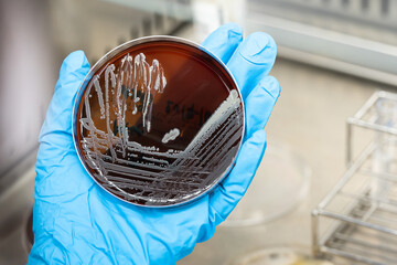 Scientist hand wearing blue gloves hold agar plate for diagnosis bacterial or microorganism in the...