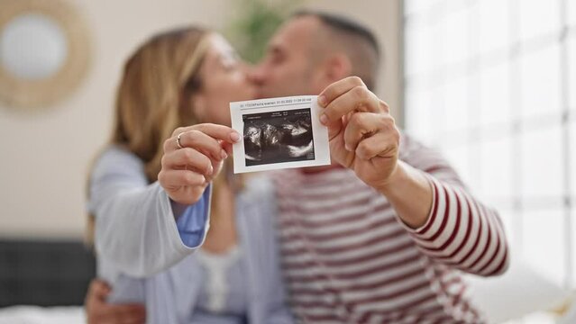 Man and woman couple holding baby ultrasound kissing at bedroom