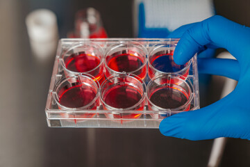 Cell culture media in laboratory for pipet.