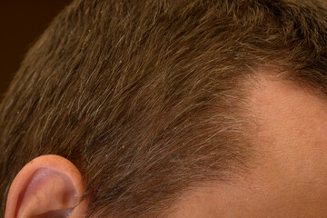 Zbliżenie na siwiejące  włosy na głowie u młodego mężczyzny
