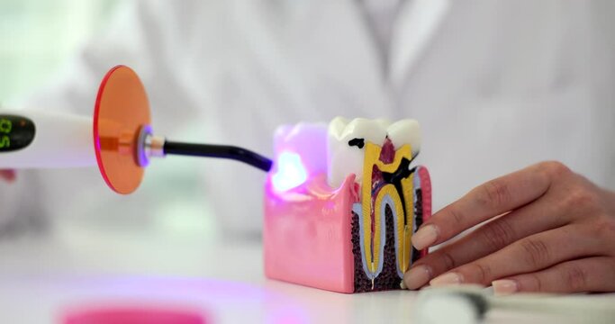 Dentist photopolymer lamp with luminous blue lamp. Dentist treats dental prosthetics puts fillings treats gum caries