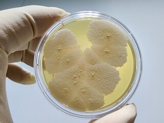 Microbial culture observation concept photo